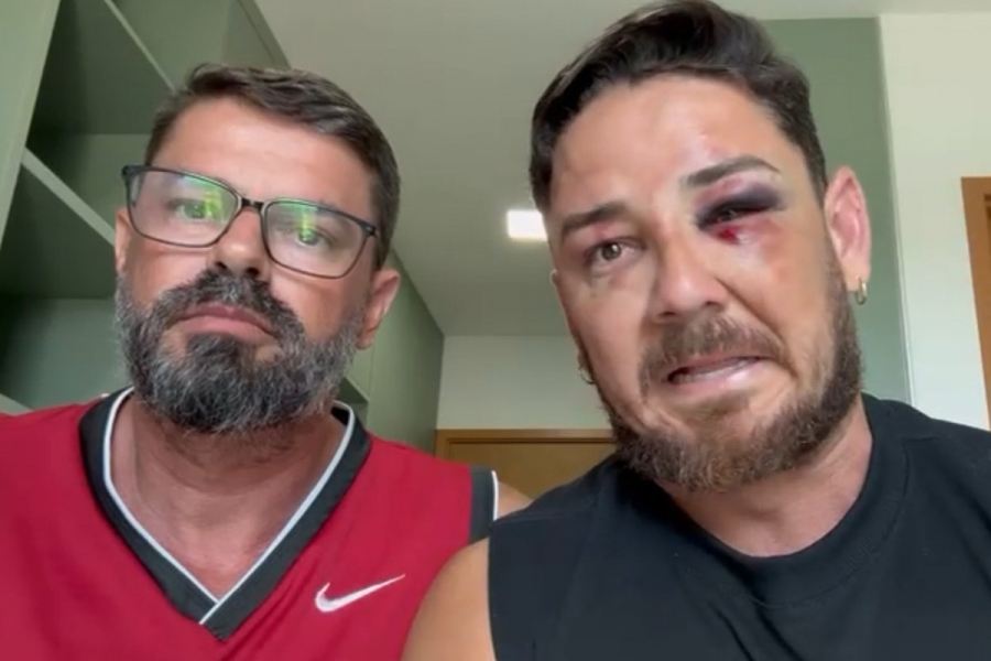 Casal diz que vai processar o governo do estado após ataque em Porto de Galinhas