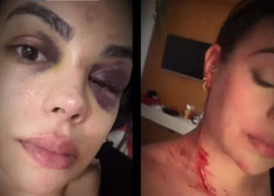 Prefeito de cidade de Pernambuco é acusado de agredir ex-companheira  
